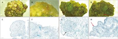 Analysis of the plant hormone expression profile during somatic embryogenesis induction in teak (Tectona grandis)